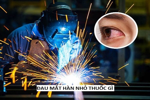 dau-mat-han-nho-thuoc-gidau-mat-han-nho-thuoc-gi