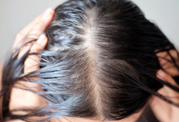 cach-cham-soc-toc-dau-khong-bi-bet