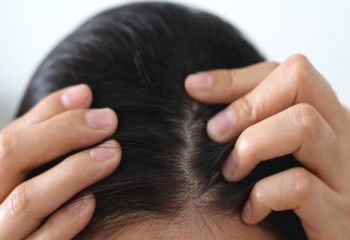 cach-cham-soc-toc-rung-nhieu-de-moc-lai-nhanh