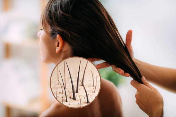 cach-cham-soc-toc-rung-nhieu-de-moc-lai-nhanh1